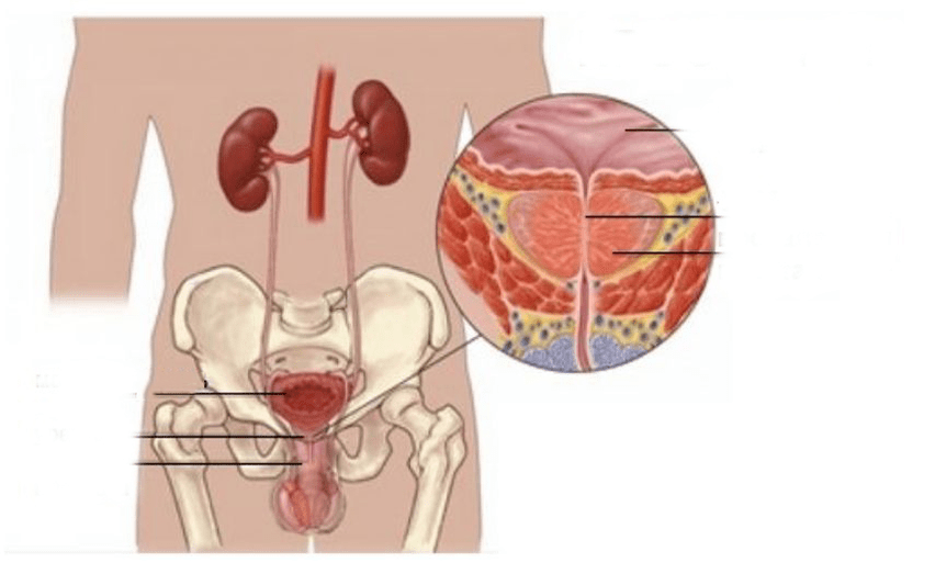 prostatitisa gizonezkoetan